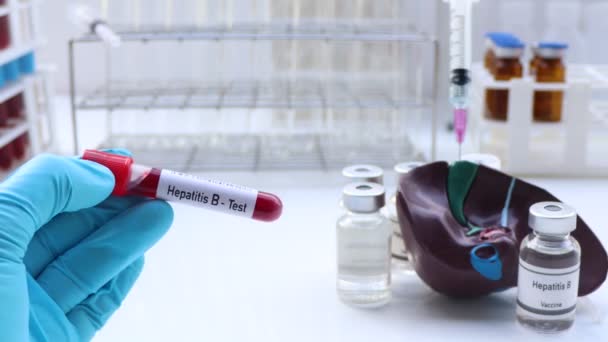 Hepatitida Test Hledat Abnormality Krve Vědecký Experiment — Stock video