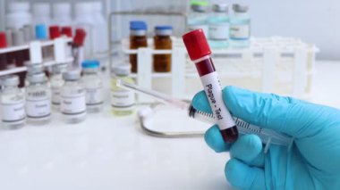 Kan ve bilimsel deneylerdeki anormallikleri bulmak için veba testi.