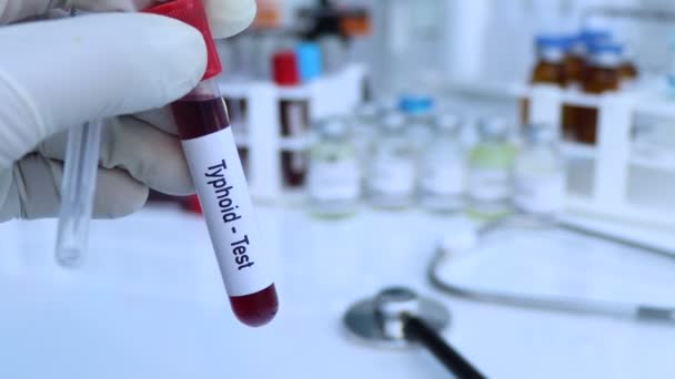 Prueba Tifoidea Para Buscar Anormalidades Sangre Experimento Científico — Vídeo de stock