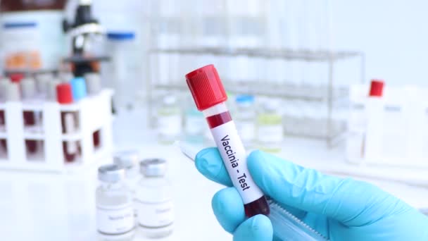Vaccinia Test Cercare Anomalie Dal Sangue Esperimento Scientifico — Video Stock