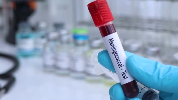 Meningokokken Test Auf Auffälligkeiten Blut Wissenschaftliches Experiment — Stockvideo