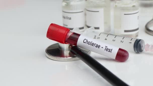 Prueba Cholerae Para Buscar Anormalidades Sangre Experimento Científico — Vídeo de stock