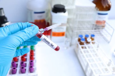Kan ve bilimsel deneydeki anormallikleri bulmak için grip testi.
