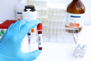 Kandaki anormallikleri araştırmak için dang testi, bilimsel deney.