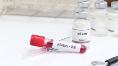 Kan ve bilimsel deneydeki anormallikleri bulmak için grip testi.
