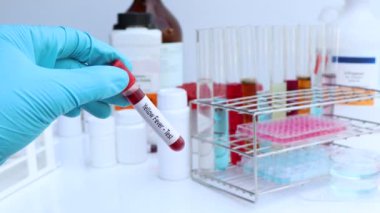 Kan ve bilimsel deneylerdeki anormallikleri araştırmak için sarı humma testi
