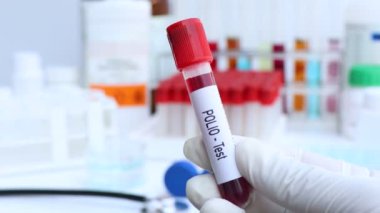 Kan ve bilimsel deneydeki anormallikleri araştırmak için POLIO testi