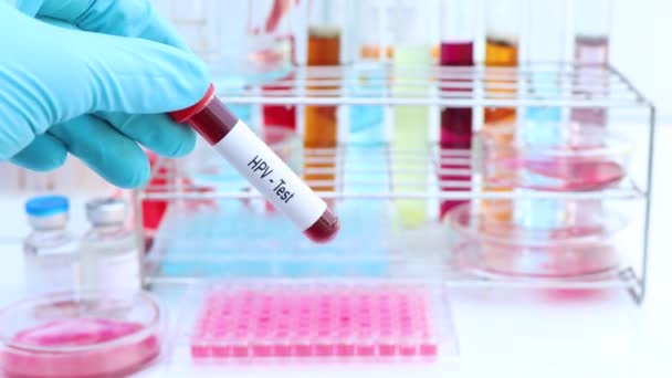 Hpvテスト 血液からの異常を探すために 科学実験 — ストック動画