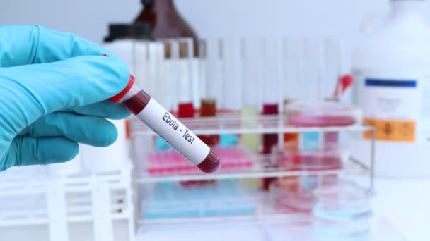 科学実験からの異常を探すためのエボラ検査 — ストック動画