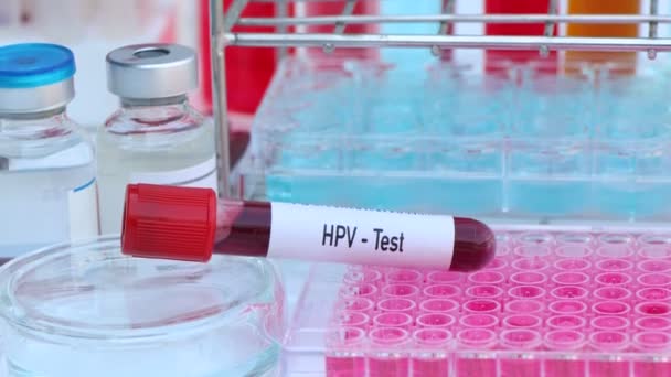 Hpvテスト 血液からの異常を探すために 科学実験 — ストック動画