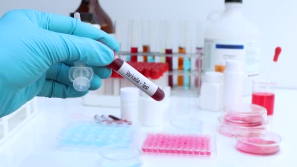 Prueba Varicela Para Buscar Anormalidades Sangre Experimento Científico — Vídeo de stock