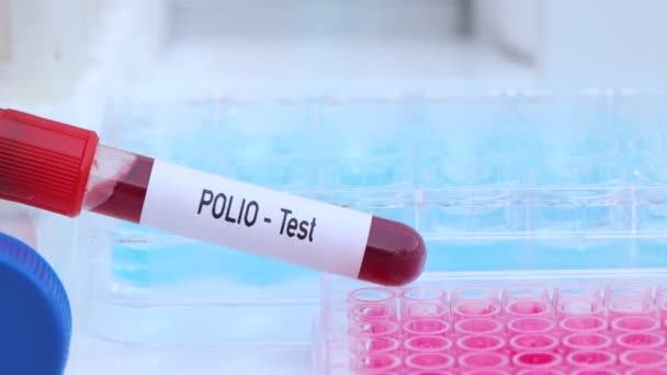 Teste Polio Para Procurar Anormalidades Sangue Experiência Científica — Vídeo de Stock