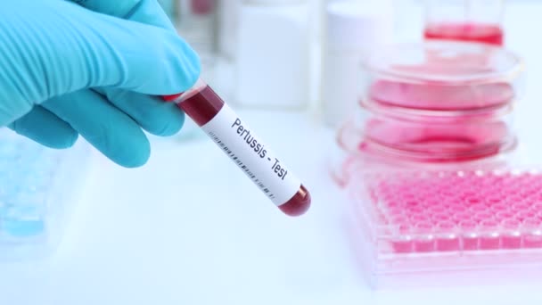 Prueba Tos Ferina Para Buscar Anomalías Sangre Experimento Científico — Vídeo de stock