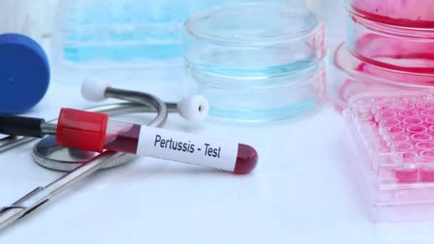 Kan Bilimsel Deneydeki Anormallikleri Bulmak Için Pertusis Testi — Stok video