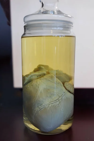 Pig heart Preserved in a Yellow Liquid in a Glass Jar.