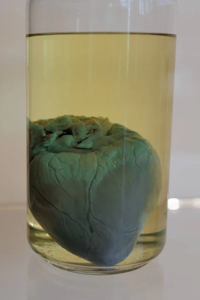 Pig heart Preserved in a Yellow Liquid in a Glass Jar.