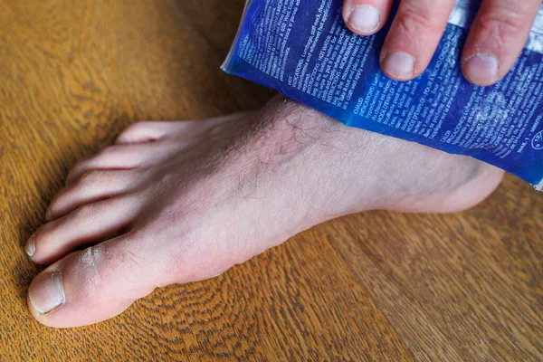 Treatment Blue Ice Envelope Large Bruise Heel Foot Stretching Injury — Stock Photo, Image