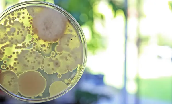 Mould Test Petri Dish Culture Medium Spore Colonies Measuring Mold Stock Photo