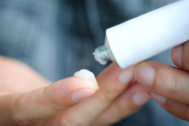 Kadının eli, steroid kullanıyor. Dış tipi uygula.