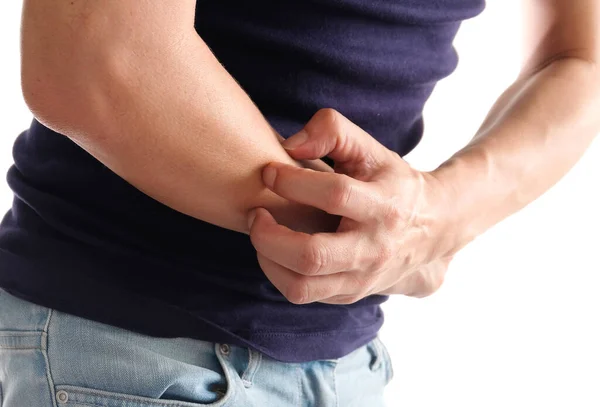 Ręce Mężczyzny Drapią Się Plecach Powodu Zapalenia Skóry Swędzenia — Zdjęcie stockowe