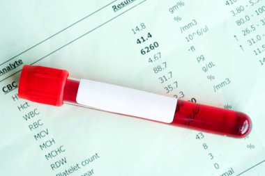 Kan örnekleri ve kan testi sonuçları. Sağlık ve tıbbi kavramlar