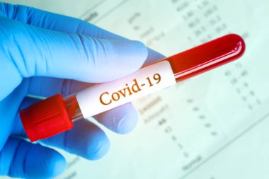 Coronavirus Covid hastalığının kan örnekleri ve kan testi sonuçları 19.Yeni salgın önleme konsepti