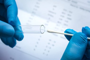 Doktor COVID-19 numune koleksiyonu yapıyor, mavi eldiven ve PPE koruyucu maske takıyor ve OP NP ve Coronavirus 'u test etmek için test tüpü taşıyor..