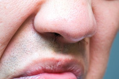 Genç bir adam kötü kokudan kaçarak, pis kokulu burnunu gösteriyor..