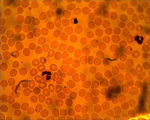 Ingrandimento 100X Rivela Danza Eritrociti Leucociti Viaggio Microscopico Attraverso Cellule — Foto Stock
