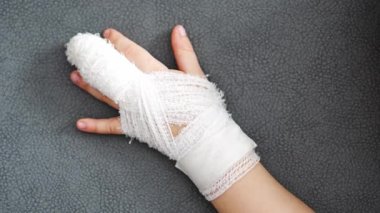 View of broken child finger at the doctors appointment in the hospital. High quality 4k footage