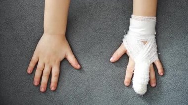 View of broken child finger at the doctors appointment in the hospital. High quality 4k footage
