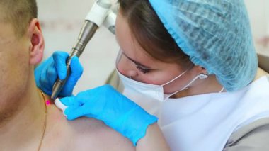 Bir dermatolog, deri tümörlerini lazerle temizler. Deri hastalıklarını yok etme sürecini yakından inceler. Yüksek kalite fotoğraf
