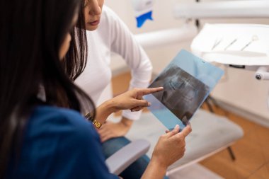 X-ray muayene detayları, dişçi muayenehanesinde kadın doktor ve hasta tarafından muayene edilmek, ilaç ve tıbbi tedavi