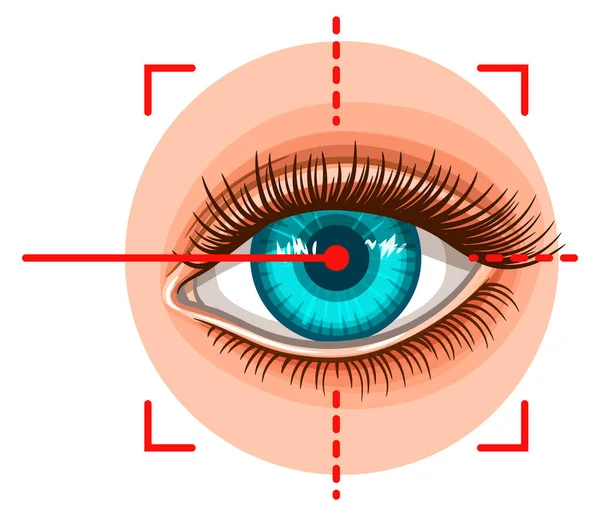 Laser Operasi Mata Koreksi Penglihatan Dengan Sinar Cahaya Prosedur Medis - Stok Vektor