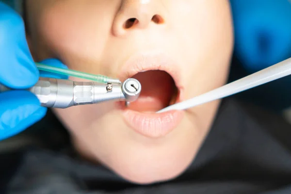 Erkek Dişçinin Dişçi Sandalyesinde Kadın Hastayla Oral Tedavi Yaparken Çekilmiş — Stok fotoğraf