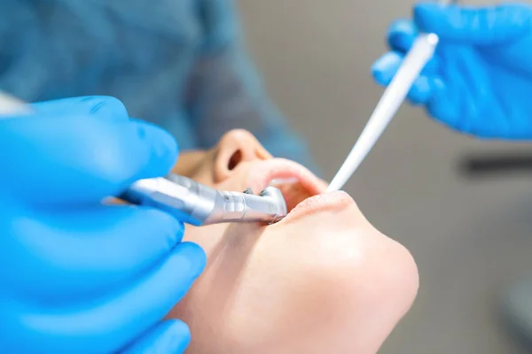 Zbliżenie Zdjęcie Męskiego Dentysty Pacjentką Fotelu Stomatologicznym Zapewniającym Leczenie Jamy — Zdjęcie stockowe