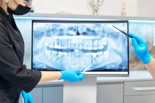 Zahnärzte Zeigen Für Patientin Röntgenbild Mit Plan Und Behandlungsergebnis — Stockfoto