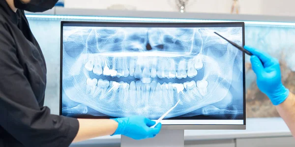 Dentist doctor showing for female patient x-ray with plan and result of treatment