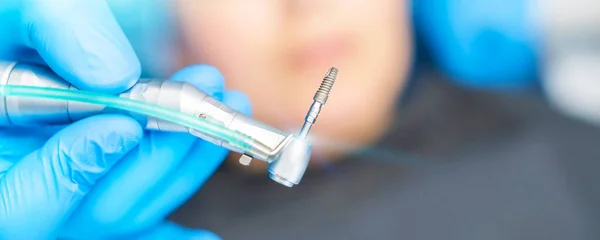 Diş Hekiminin Eline Diş Implantı Yerleştirirken Yakın Plan Fotoğrafı — Stok fotoğraf