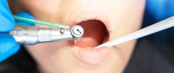 Nahaufnahme Eines Männlichen Zahnarztes Mit Einer Patientin Zahnarztstuhl Zur Behandlung — Stockfoto