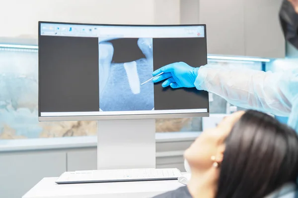 Οδοντίατρος Δείχνει Για Γυναίκα Ασθενή Ακτινογραφία Σχέδιο Και Αποτέλεσμα Της — Φωτογραφία Αρχείου