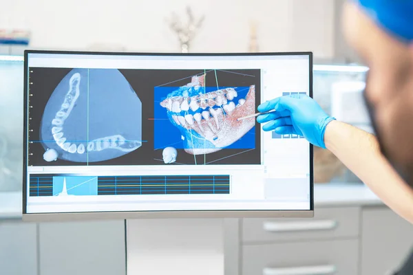 Dişçi Doktor Hastanın Röntgenini Planlı Tedavi Sonucu Çekiyor — Stok fotoğraf