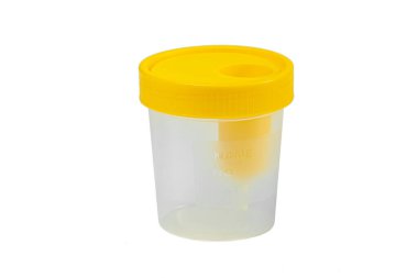 Beyaz arka planda tıbbi testler yapmak için plastik kap. Tıbbi ekipman.