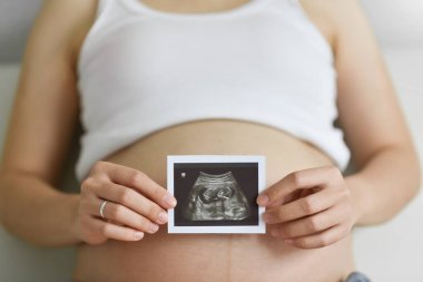 Karnında ultrason fotoğrafı tutan hamile bir kadın var. Hamilelik kavramı, doğum öncesi bakım