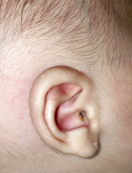 Newborn Ear Ear Cleaning Babies Earwax — Stock Photo, Image