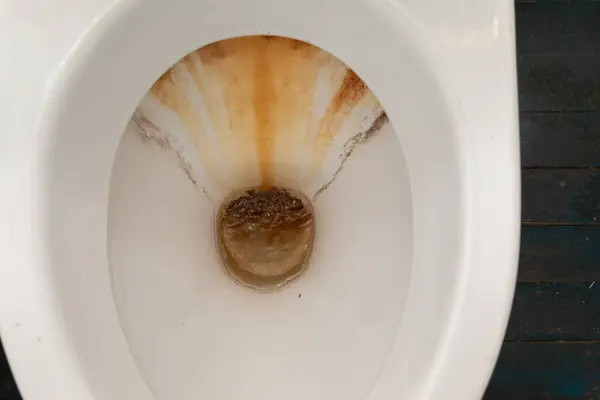 Dette Nærbilde Viser Toalettskål Som Inneholder Brun Substans Fokuset Toalettets – stockfoto