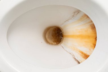 A white toilet bowl is shown with a brown substance inside. The image captures an unclean toilet that requires cleaning to maintain hygiene and cleanliness. clipart