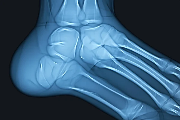Röntgen Kafa Ayak Kafa Ağız Kaburga Ellerin Röntgeni Kemik Taraması — Stok fotoğraf