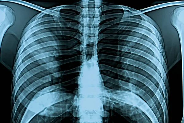 Рентген Рентген Головы Ступни Головы Рта Ребер Рук Сканирование Костей — стоковое фото
