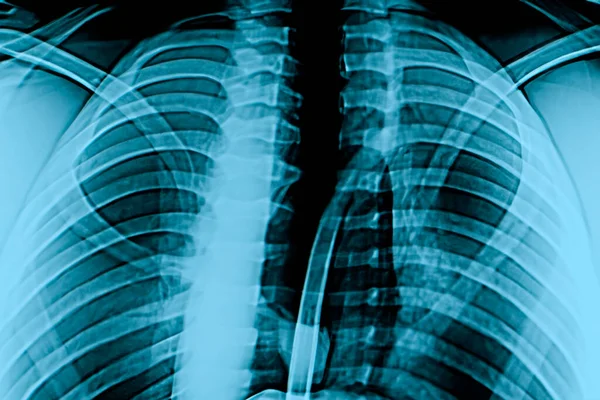 Röntgen Röntgen Von Kopf Fuß Kopf Mund Rippen Und Händen — Stockfoto